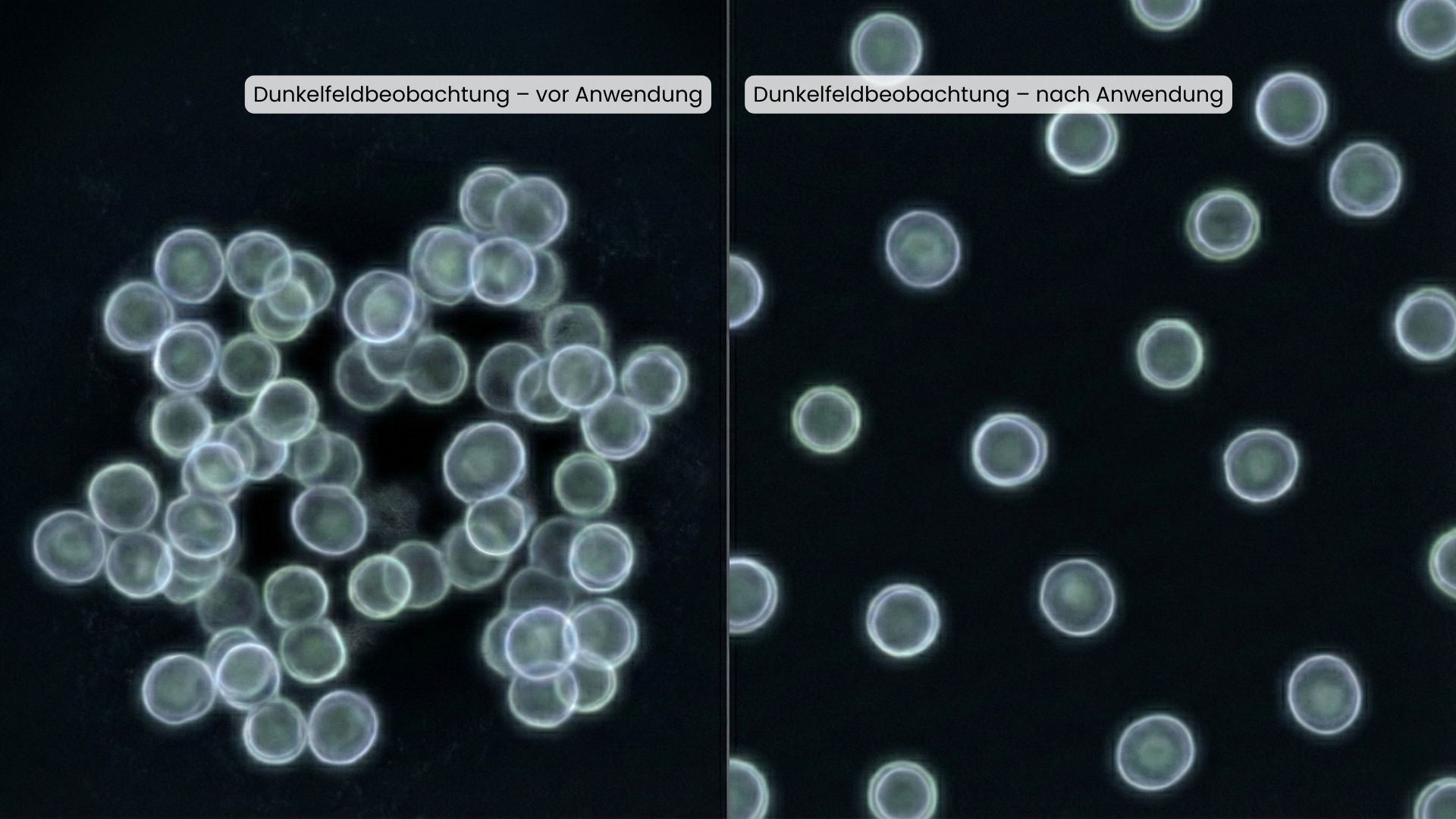 Qualitative Dunkelfeldvisualisierung zellähnlicher Strukturen – Vergleich einer Beobachtung vor Anwendung und nach Anwendung unter gleichen Bedingungen.